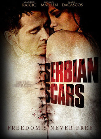 Serbian Scars